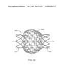 Double-Walled Stent System diagram and image