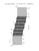 Double-Walled Stent System diagram and image