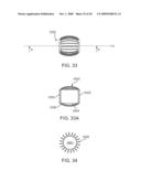 Double-Walled Stent System diagram and image