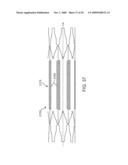 Double-Walled Stent System diagram and image