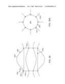 Double-Walled Stent System diagram and image