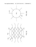 Double-Walled Stent System diagram and image