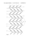 MEDICAL SUPPORTING IMPLANT, IN PARTICULAR STENT diagram and image