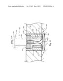 Skull endosseous implant and kit containing the same diagram and image