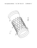 Bariatric sleeve diagram and image