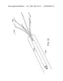 Bariatric sleeve diagram and image