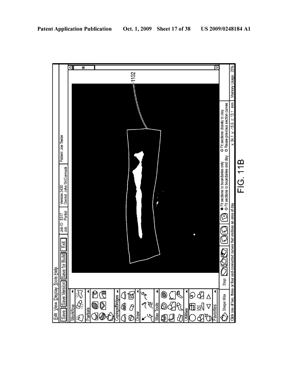 Haptically enabled dental modeling system - diagram, schematic, and image 18