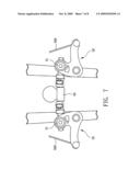 Brake pad holder with arrangement for fine adjustment of a distance between brake pad and wheel rim diagram and image