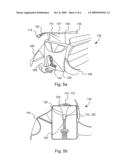 Protective Transport Bag diagram and image