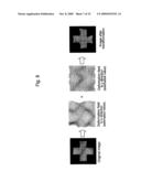 Method for assisting in diagnosis of cerebral diseases and apparatus thereof diagram and image