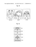 Method for assisting in diagnosis of cerebral diseases and apparatus thereof diagram and image