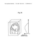 Method for assisting in diagnosis of cerebral diseases and apparatus thereof diagram and image