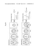 Method for assisting in diagnosis of cerebral diseases and apparatus thereof diagram and image