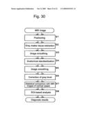 Method for assisting in diagnosis of cerebral diseases and apparatus thereof diagram and image