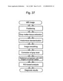 Method for assisting in diagnosis of cerebral diseases and apparatus thereof diagram and image