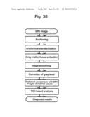 Method for assisting in diagnosis of cerebral diseases and apparatus thereof diagram and image