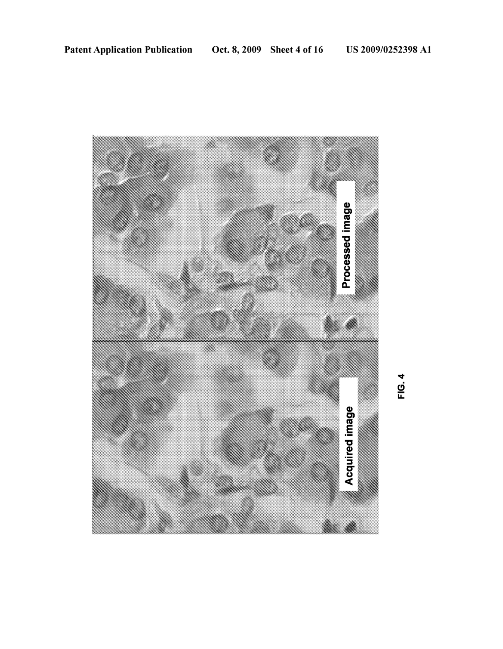 Method and System for Creating a Three-Dimensionally-Perceived Image of a Biological Sample - diagram, schematic, and image 05