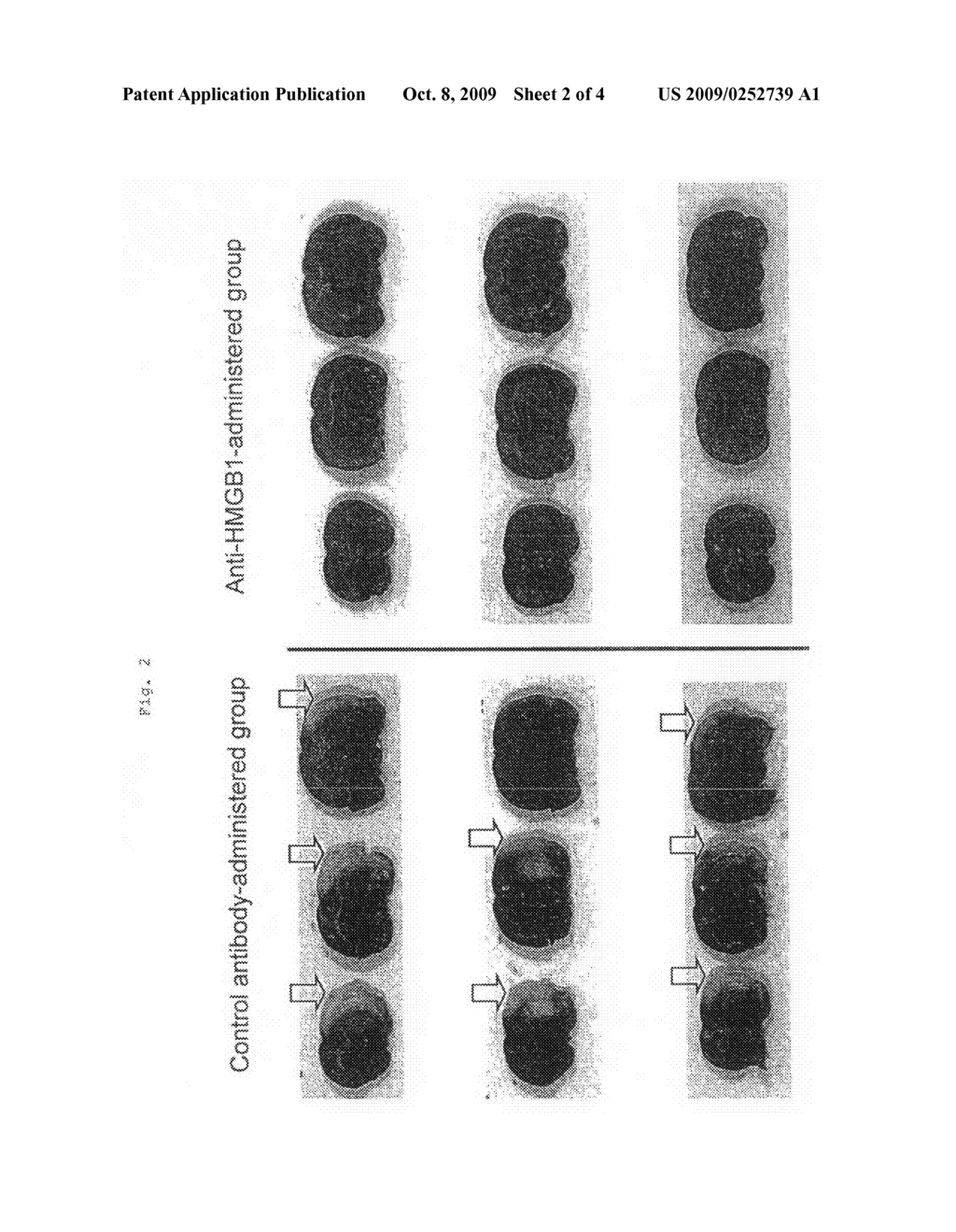 Cerebral Infarction Suppressant - diagram, schematic, and image 03