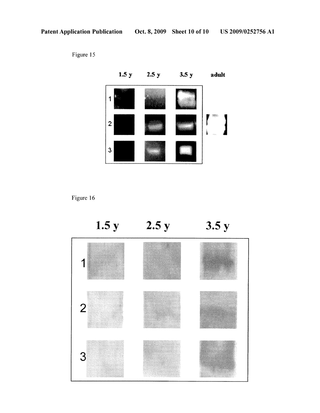 PROTEIN-BASED STREPTOCOCCUS PNEUMONIAE VACCINES - diagram, schematic, and image 11