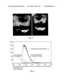 APPARATUS FOR DETECTING INFECTED TISSUE diagram and image