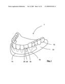 METHOD AND APPARATUS FOR MANUFACTURING ORTHODONTIC APPLIANCES diagram and image