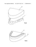 METHOD AND APPARATUS FOR MANUFACTURING ORTHODONTIC APPLIANCES diagram and image