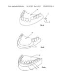 METHOD AND APPARATUS FOR MANUFACTURING ORTHODONTIC APPLIANCES diagram and image