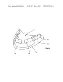 METHOD AND APPARATUS FOR MANUFACTURING ORTHODONTIC APPLIANCES diagram and image