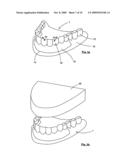METHOD AND APPARATUS FOR MANUFACTURING ORTHODONTIC APPLIANCES diagram and image