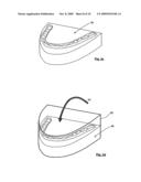 METHOD AND APPARATUS FOR MANUFACTURING ORTHODONTIC APPLIANCES diagram and image