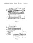 DISTAL END PORTION OF ENDOSCOPE diagram and image