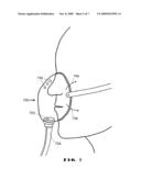 CLINICAL MONITORING IN OPEN RESPIRATORY AIRWAYS diagram and image