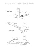 SKIN BIOPSY WITH AUTOMATED LESION STABILIZATION AND RESECTION diagram and image