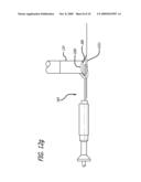 SKIN BIOPSY WITH AUTOMATED LESION STABILIZATION AND RESECTION diagram and image