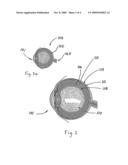 METHOD AND APPARATUS FOR SUTURELESS INJECTABLE RETINAL DETACHMENT SPONGE IMPLANTATION diagram and image