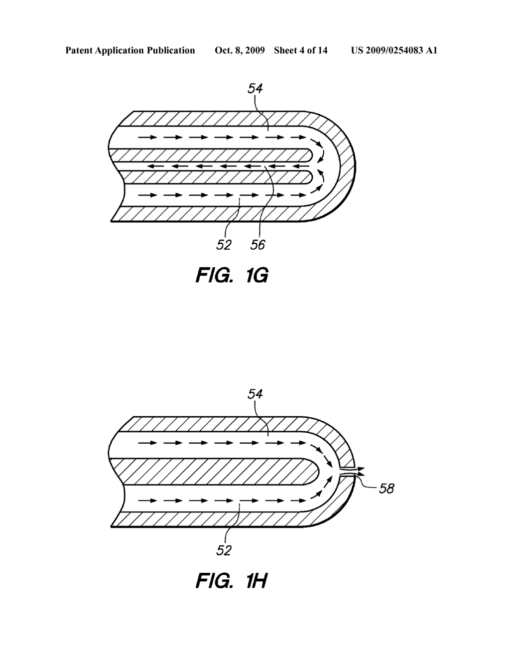 ROBOTIC ABLATION CATHETER - diagram, schematic, and image 05