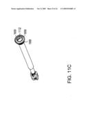 STABILIZATION SYSTEM AND METHOD FOR THE FIXATION OF BONE FRACTURES diagram and image