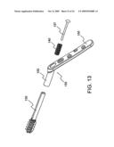 STABILIZATION SYSTEM AND METHOD FOR THE FIXATION OF BONE FRACTURES diagram and image