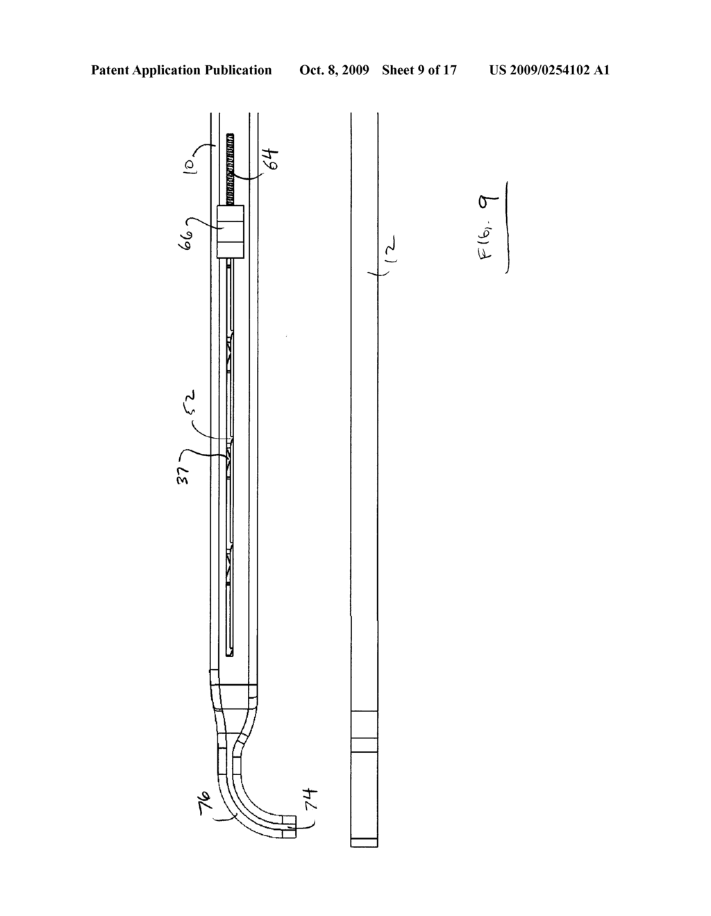 DELIVERY MECHANISM FOR TISSUE HOLDING IMPLANTS - diagram, schematic, and image 10