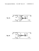 Venous Filter with Detachable Anchors diagram and image