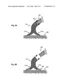 Venous Filter with Detachable Anchors diagram and image