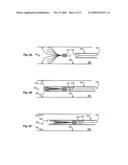 Venous Filter with Detachable Anchors diagram and image