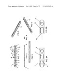 COMPRESSION/DISTRACTION OSTEOTOMY SYSTEM, PLATE, METHOD, DRILL GUIDE AND SAW GUIDE diagram and image