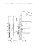 COMPRESSION/DISTRACTION OSTEOTOMY SYSTEM, PLATE, METHOD, DRILL GUIDE AND SAW GUIDE diagram and image