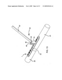 COMPRESSION/DISTRACTION OSTEOTOMY SYSTEM, PLATE, METHOD, DRILL GUIDE AND SAW GUIDE diagram and image