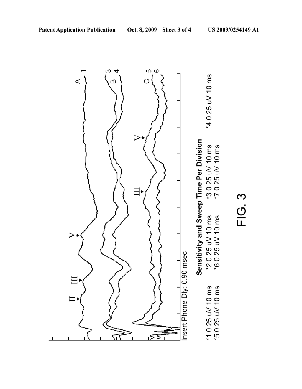 Synchronized Diagnostic Measurement for Cochlear Implants - diagram, schematic, and image 04