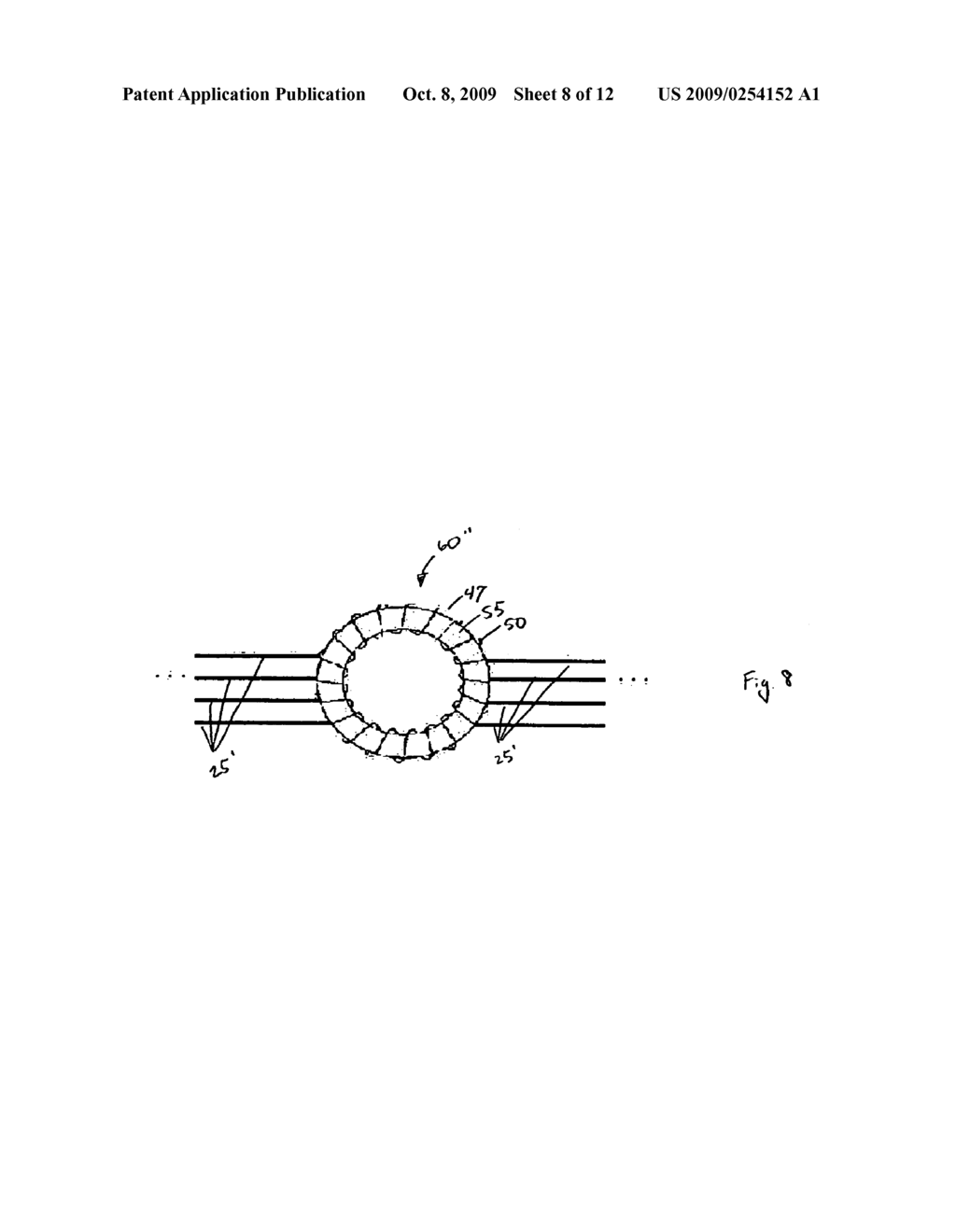 ELECTRICAL LEAD FOR AN ELECTRONIC DEVICE SUCH AS AN IMPLANTABLE DEVICE - diagram, schematic, and image 09