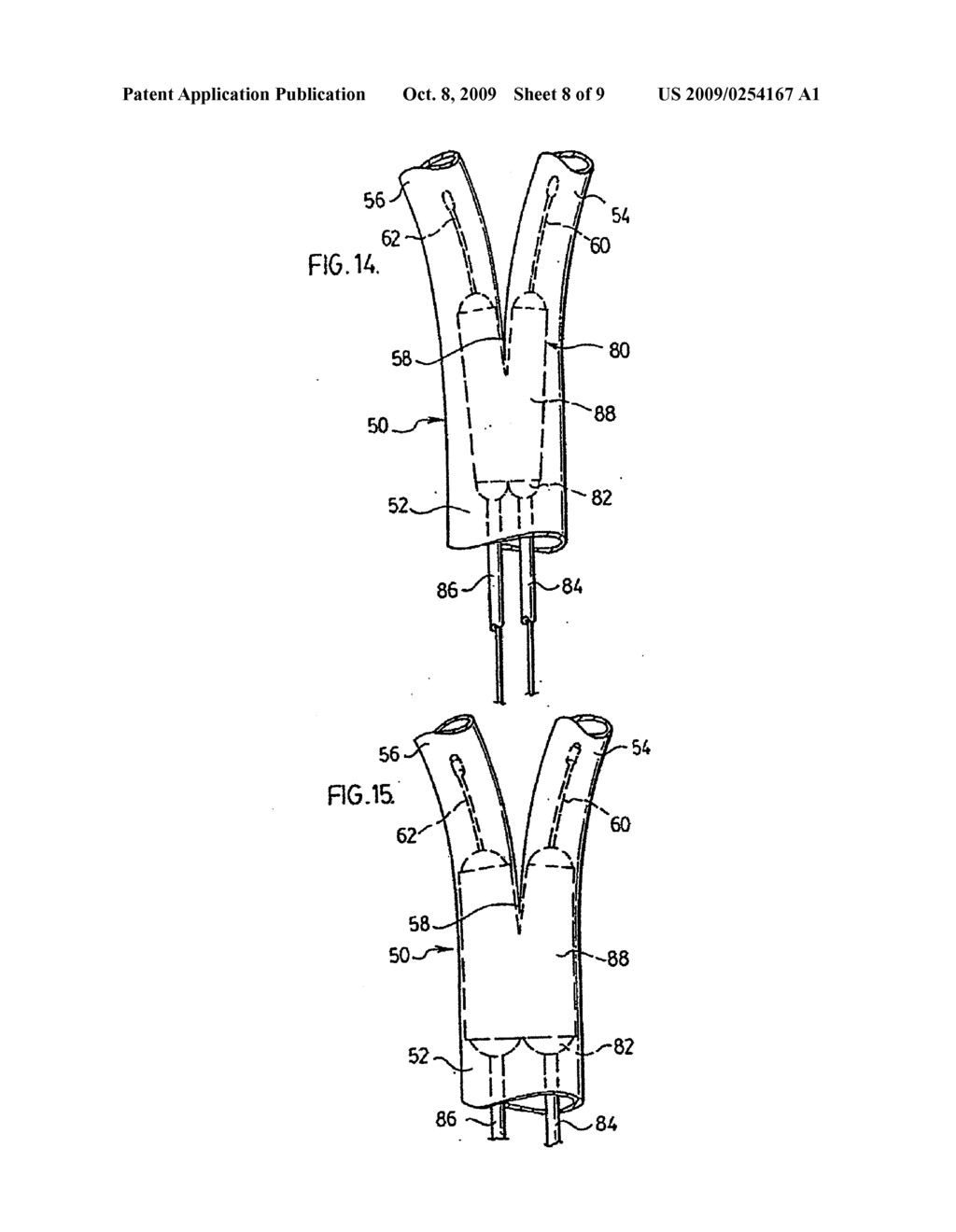 BIFURCATED STENT DELIVERY SYSTEM AND METHOD OF USE - diagram, schematic, and image 09