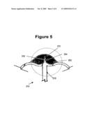 Removable Covering for Implantable Frame Projections diagram and image