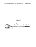 Removable Covering for Implantable Frame Projections diagram and image